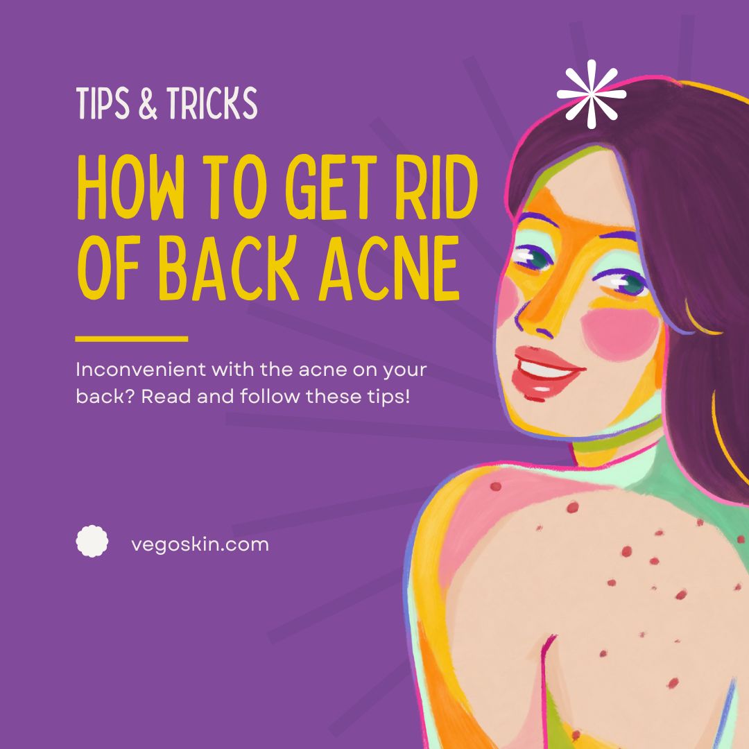 Back Acne Scars? Here’s How To Brighten And Heal