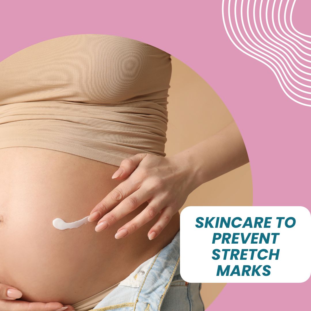 The Best Skincare To Prevent Stretch Marks During Pregnancy