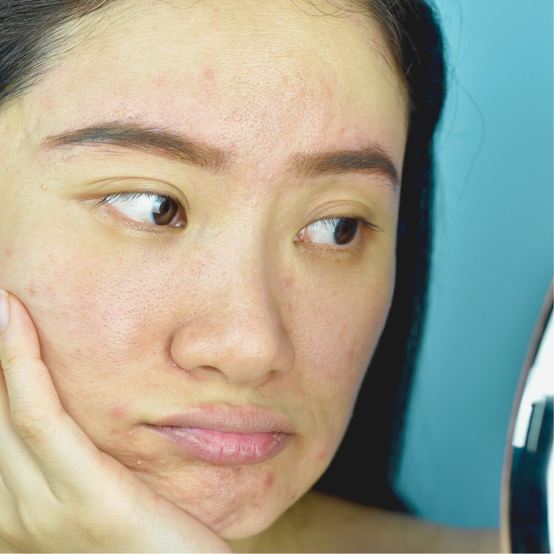 Why Your Skin Suddenly Looks Tired and Dull